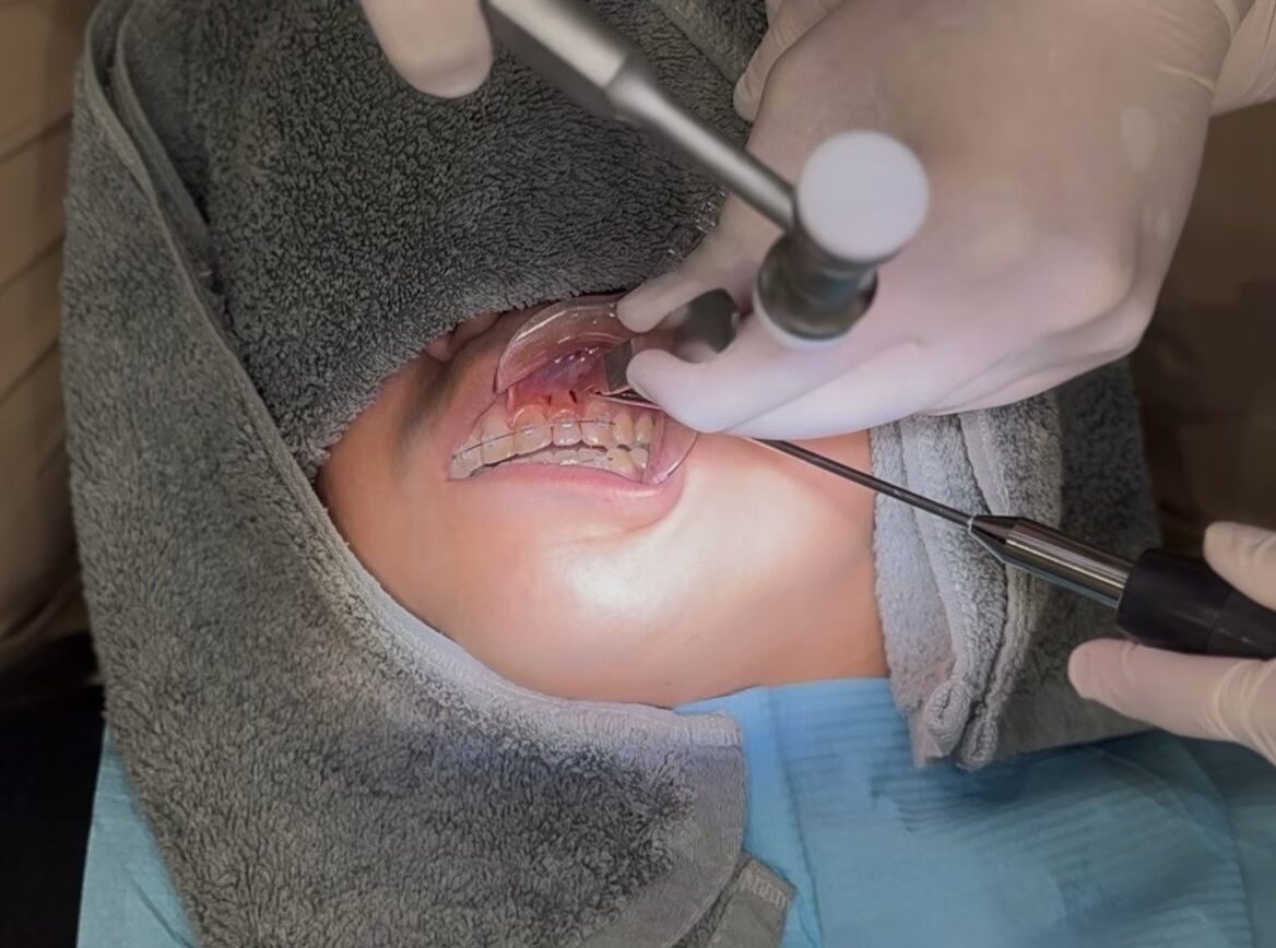 歯列矯正
品川
品川駅近く
矯正専門