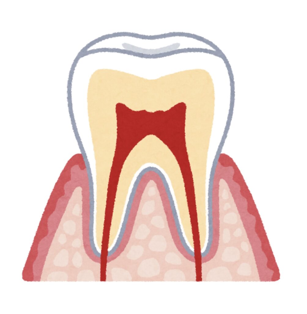 歯周組織
歯周病
歯槽骨