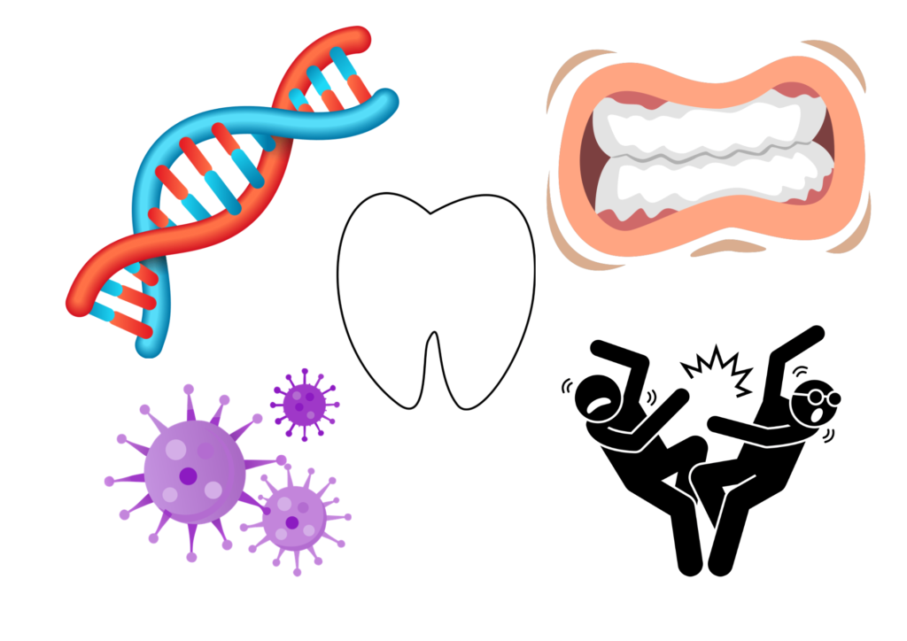 食いしばり
根管治療
遺伝
歯をぶつける
