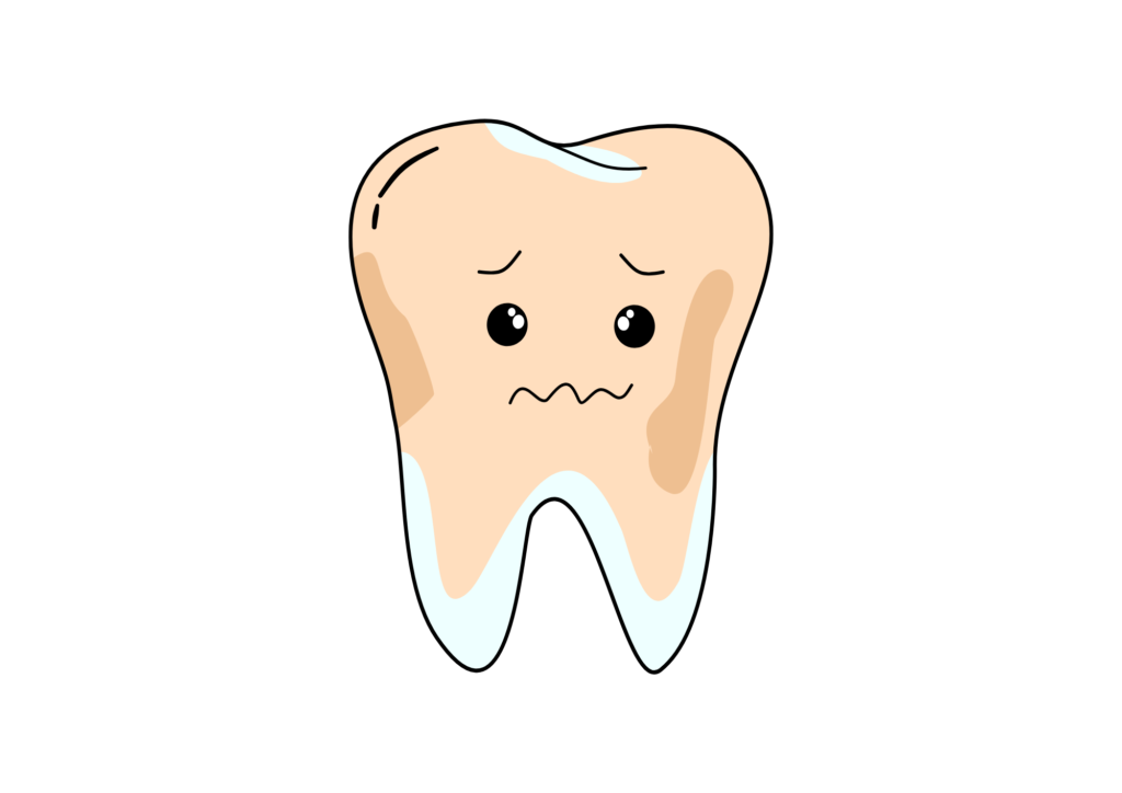 歯の着色 
歯が黄ばんでる