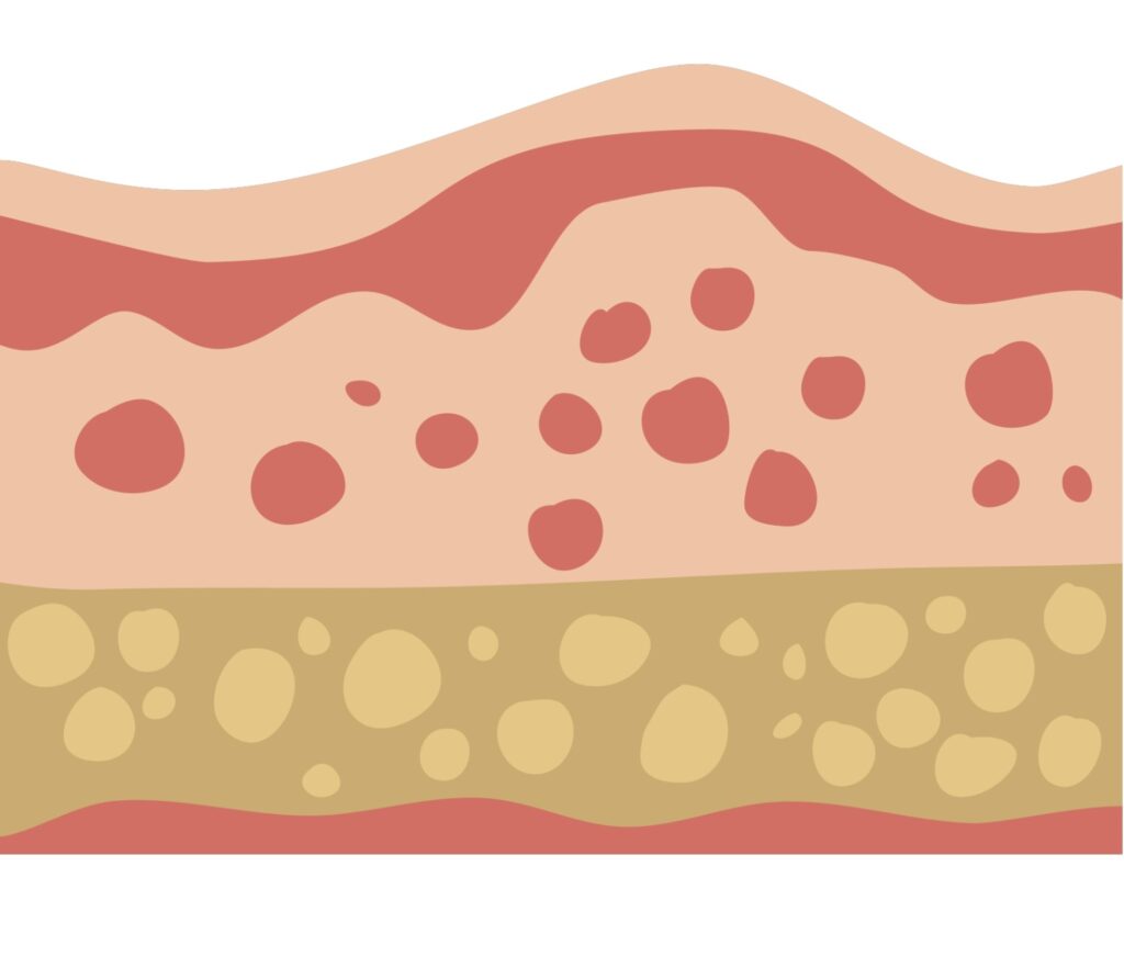 皮膚
コラーゲン
たるみ