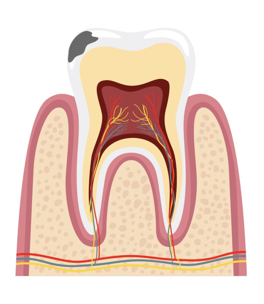 虫歯
歯列矯正
品川区
矯正歯科
